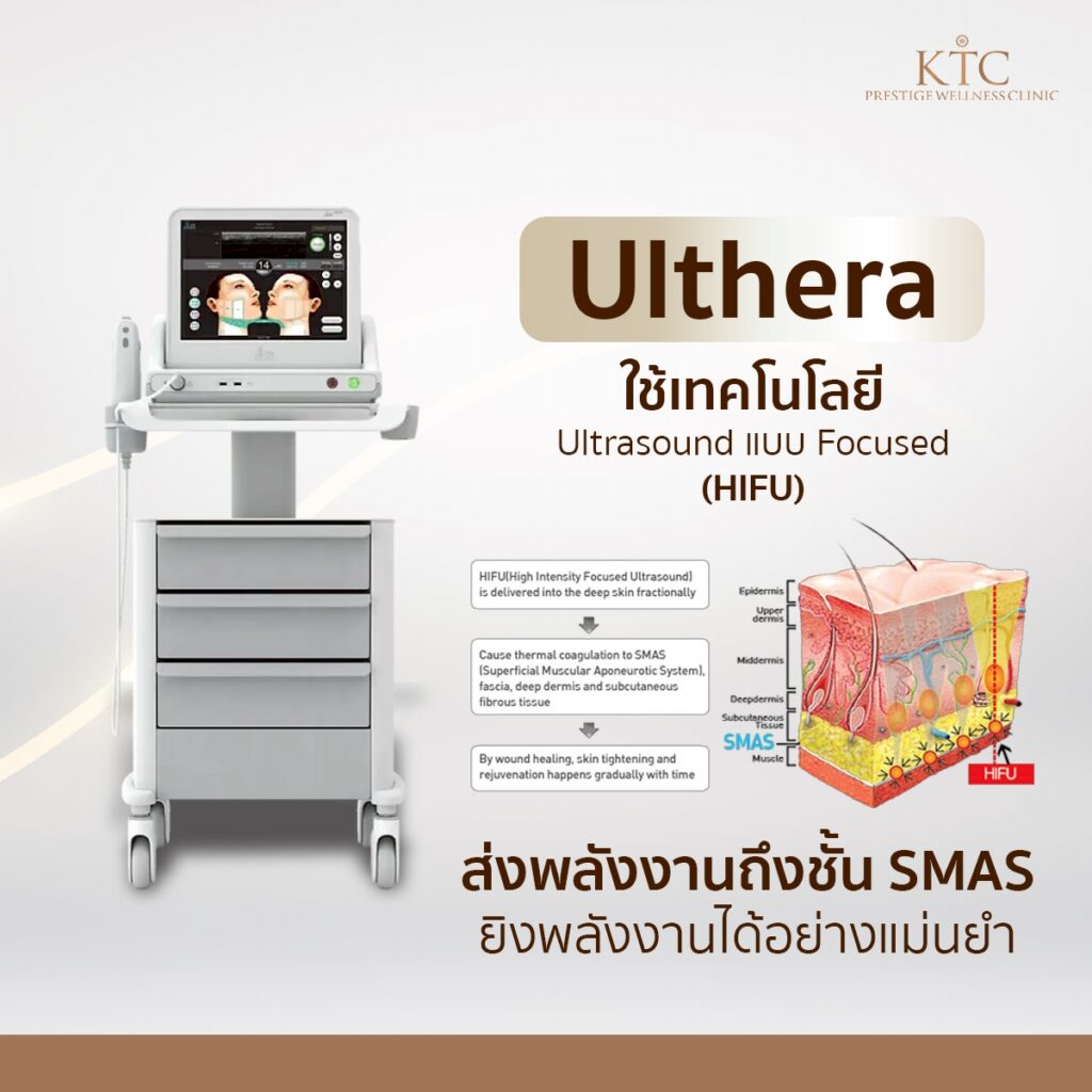 sofwave กับ ulthera